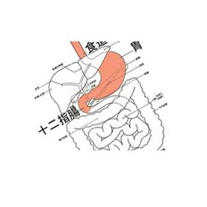 【体験談】胃の痛みにより何もできない状態で薬投与と食事制限がはじまる悪夢な胃潰瘍について書いてみた